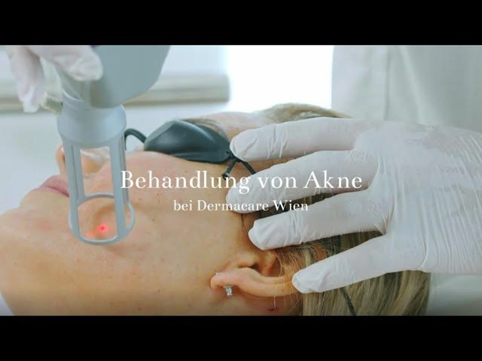 Behandlung von Akne bei Dermacare Wien
