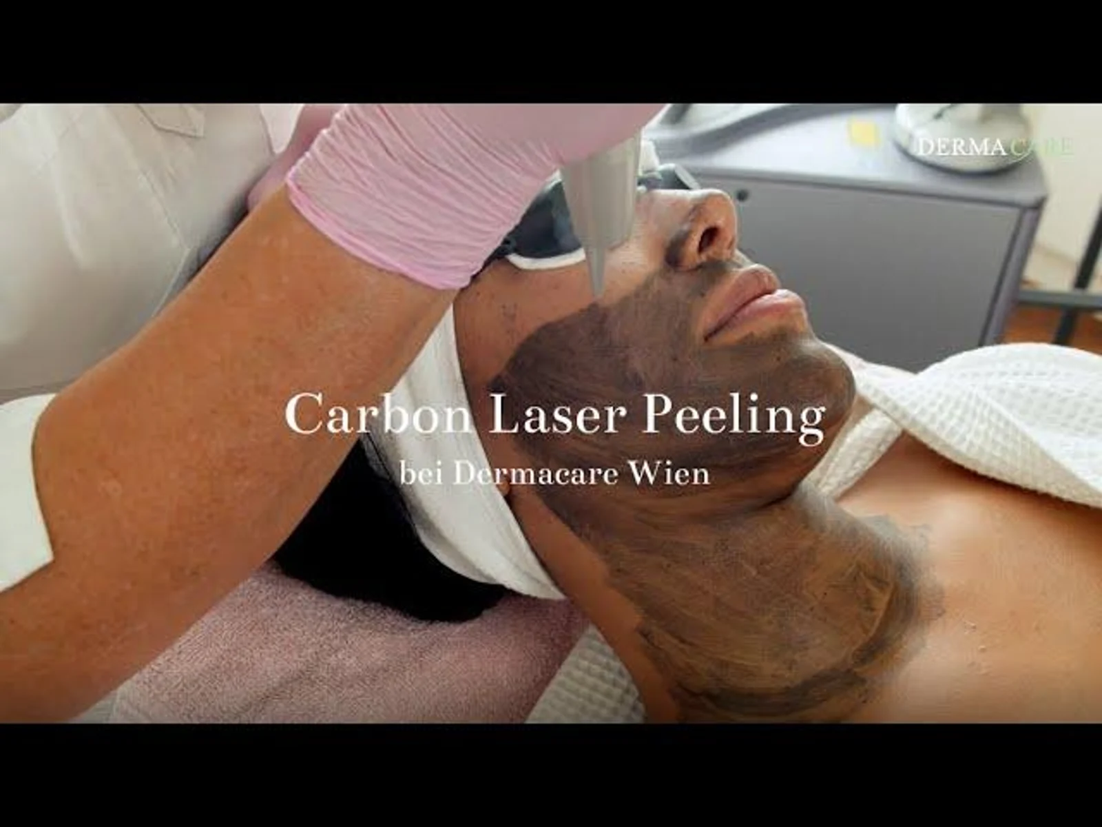 Carbonlaser Peeling bei Dermacare Wien