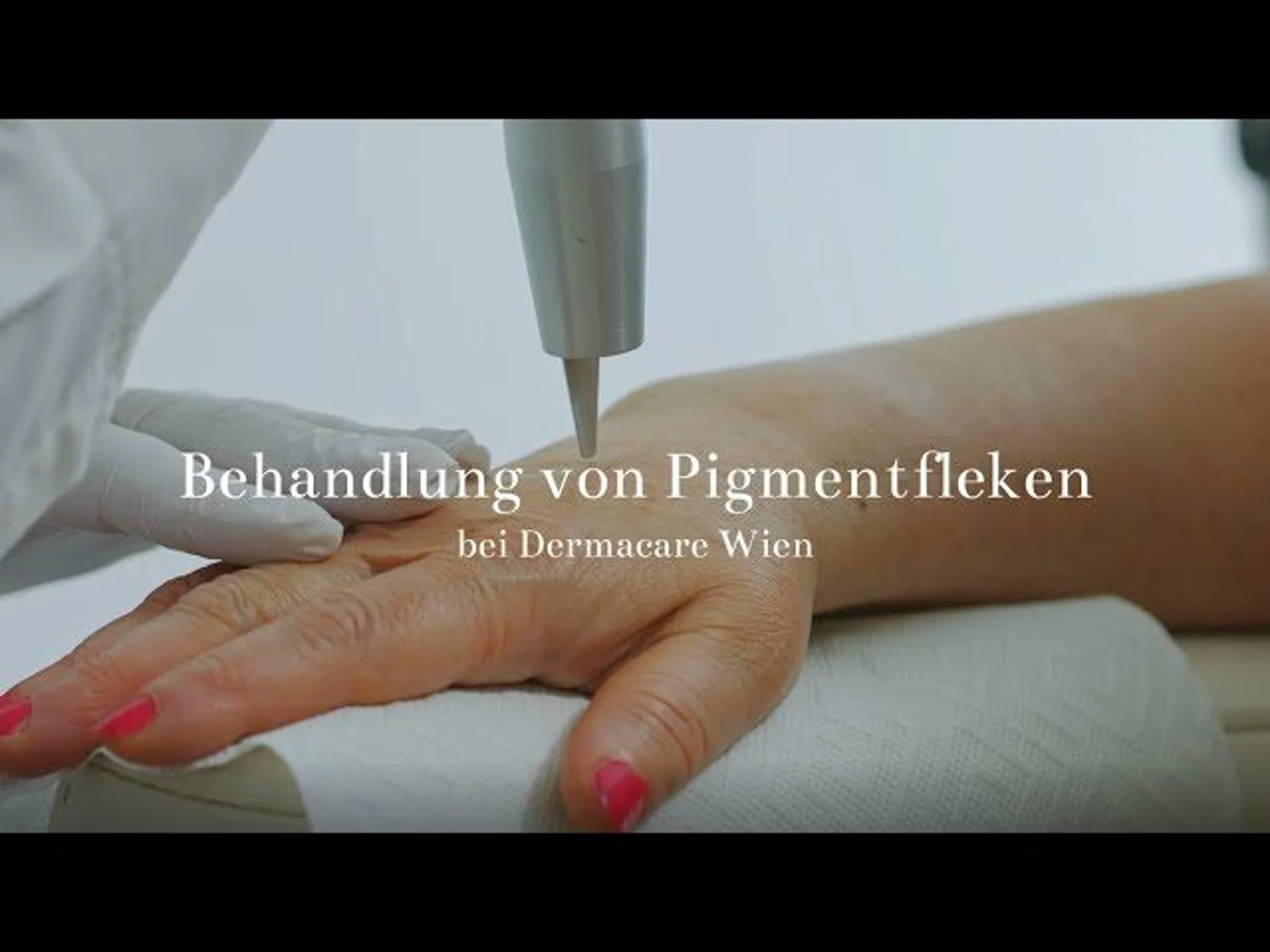 Behandlung von Pigmentflecken bei Dermacare Wien