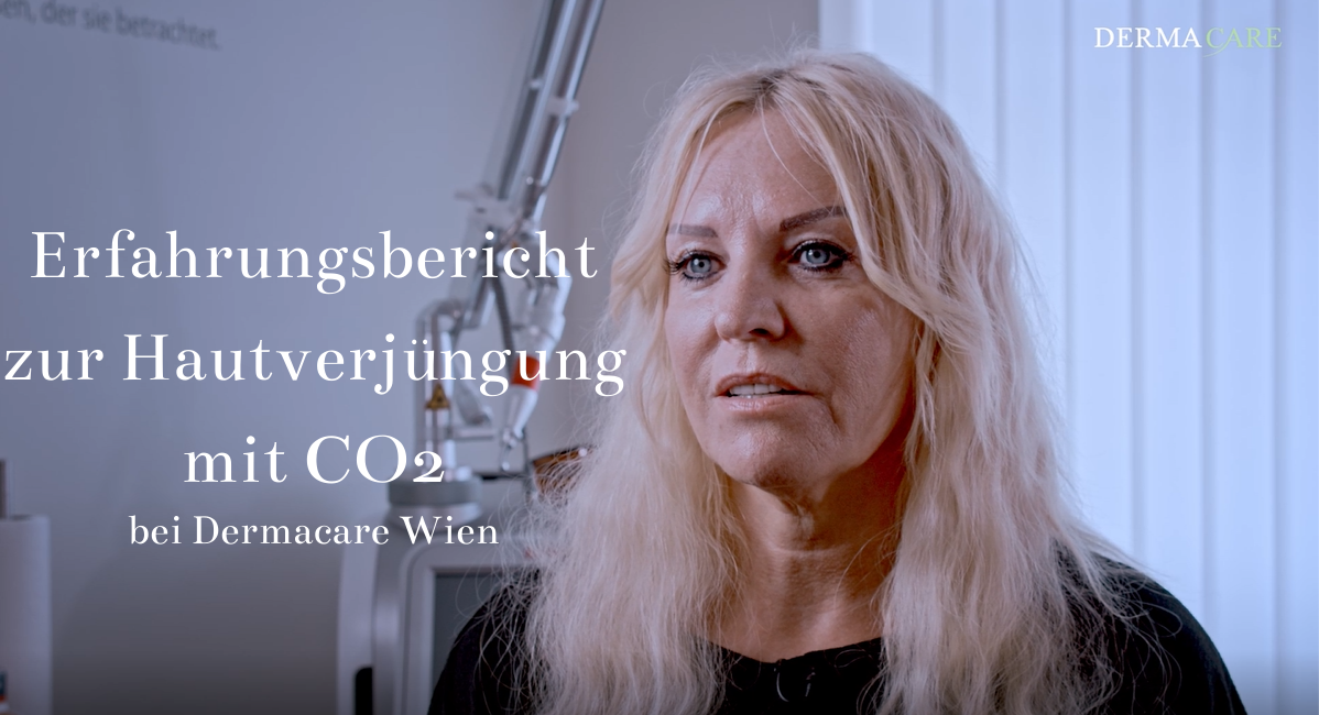 Erfahrungsbericht zur Hautverjüngung mit CO2 mit Text