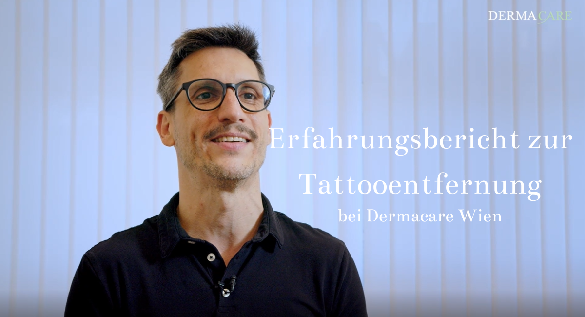 Tattoentfernung: Mann 1