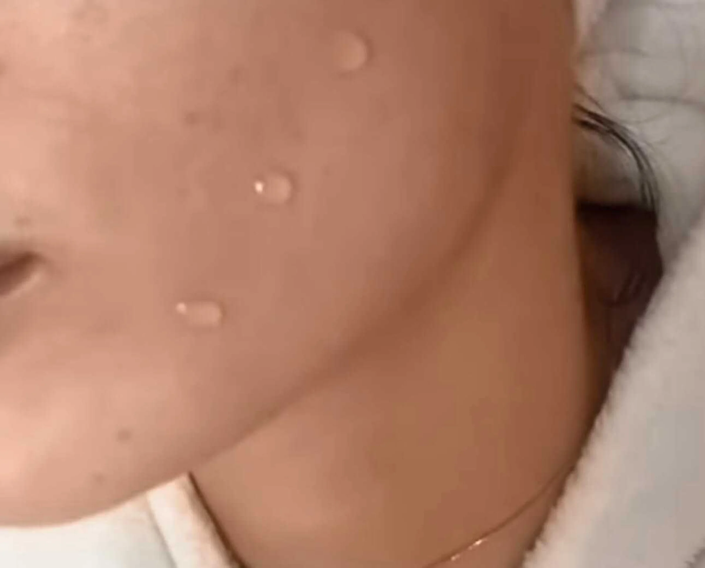 Das zweite Bild zeigt ein PQAge Peeling, ein sanftes, aber effektives professionelles Gesichtspelling von Dermacare Wien. Auf der Haut sind feine Tropfen einer Wirkstofflösung zu sehen, die tief in die Haut einwirken. Das PQAge Peeling kombiniert chemische und revitalisierende Komponenten, um die Hautstruktur zu verbessern, die Zellerneuerung anzuregen und einen strahlenden Teint zu erzeugen – ganz ohne Ausfallzeit.
