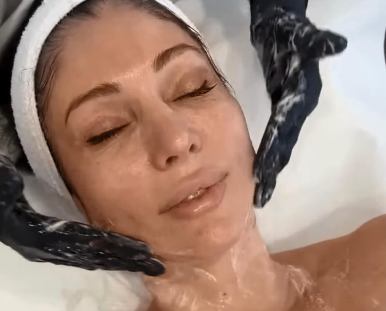 Auf diesem Bild sieht man eine Patientin die ein Fruchstäurepeeling von dermacaer wien erhaltet.