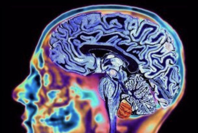 New scientific study explains why that track was so sick while you were tripping