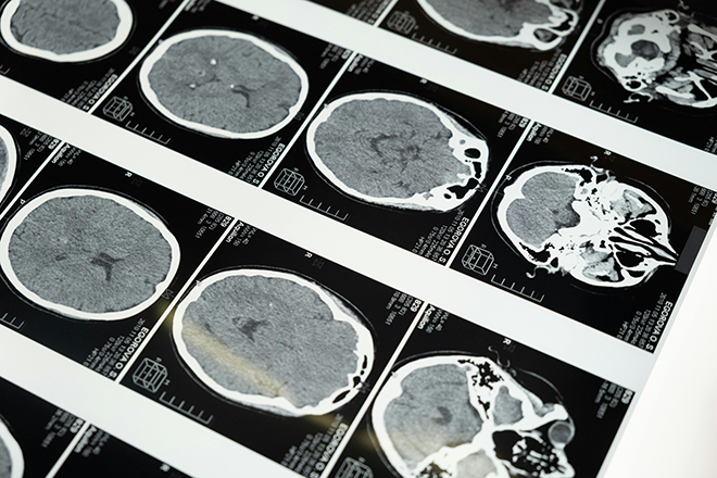 Study finds that listening to music can lower dementia risk by up to 39%