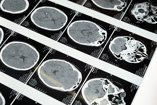 Google researchers share study showing how AI can be used to turn brain scans into music