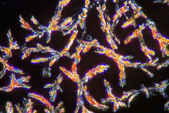 DMT to be used in trial as a treatment for depression