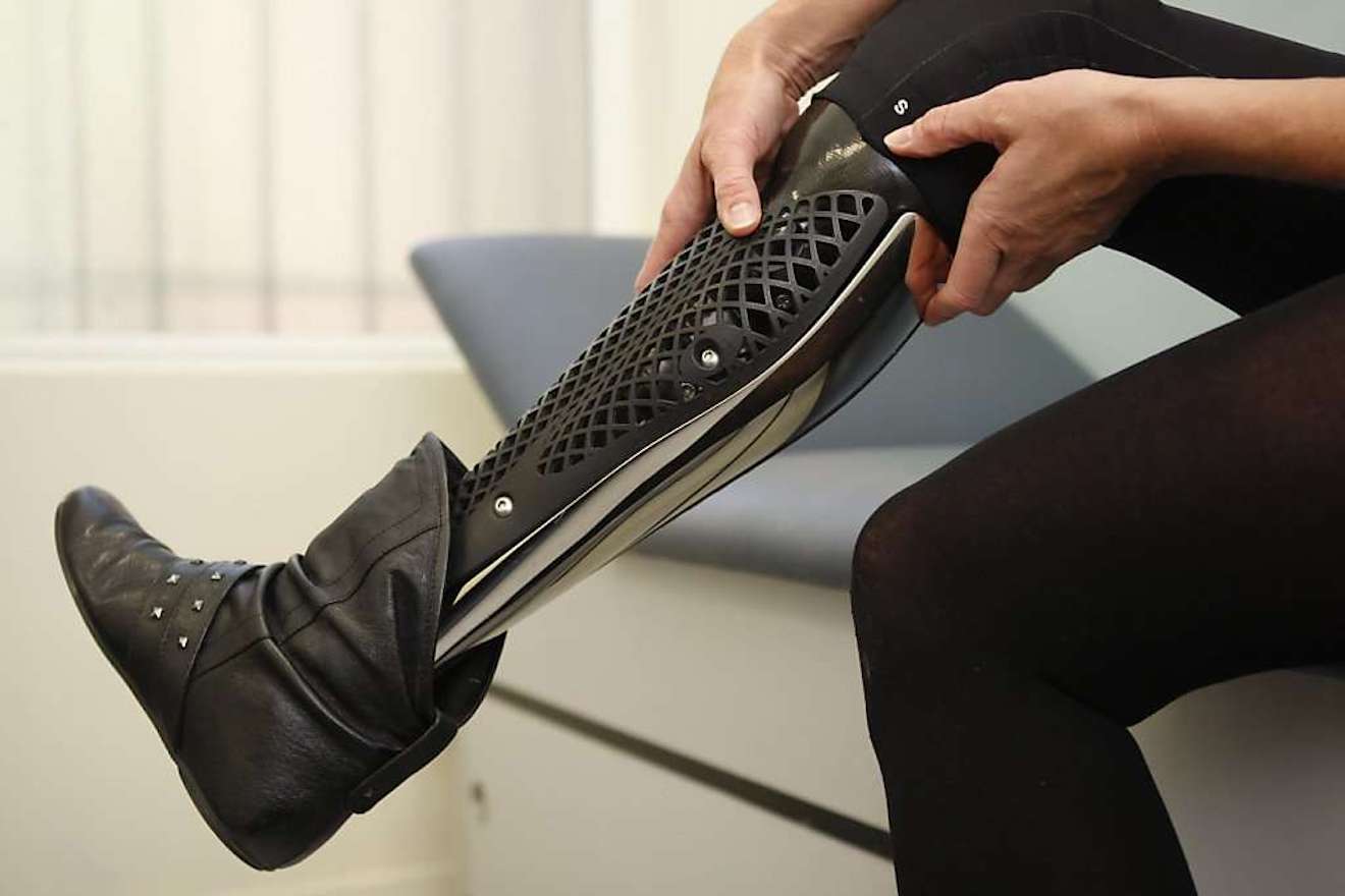 ​Amputee aims to set world record for dancing with a prosthetic leg