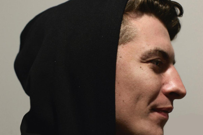 Skream forced to cancel gigs due to broken leg