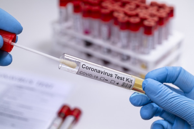 A rapid COVID-19 testing service designed for the events industry has launched