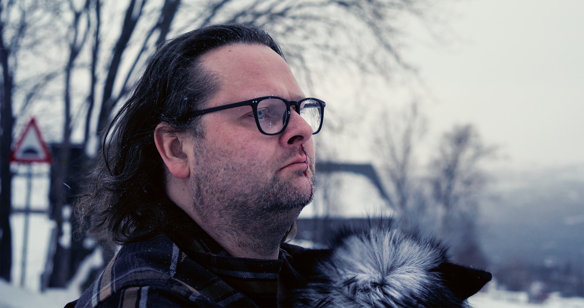 Foto. En mann med mørke briller ser mot høyre, det renner blod ut av det ene neseboret hans.