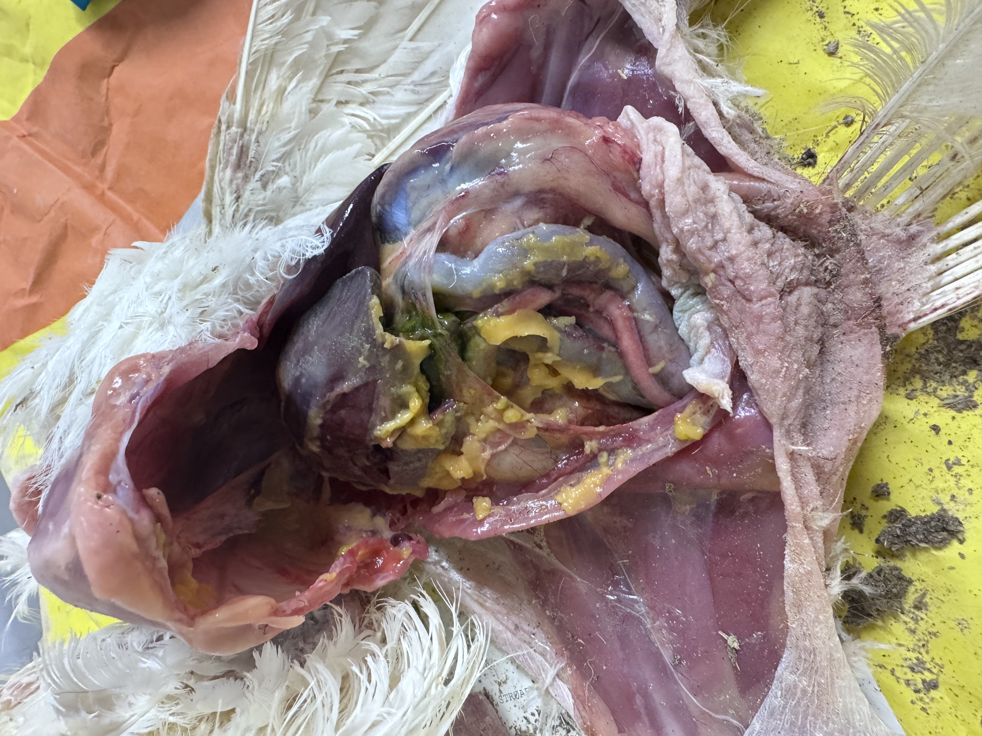 Colisepsis gir perikarditt, peritonitt og perihepatitt, med klassiske serøse hinner og fibrin over organene