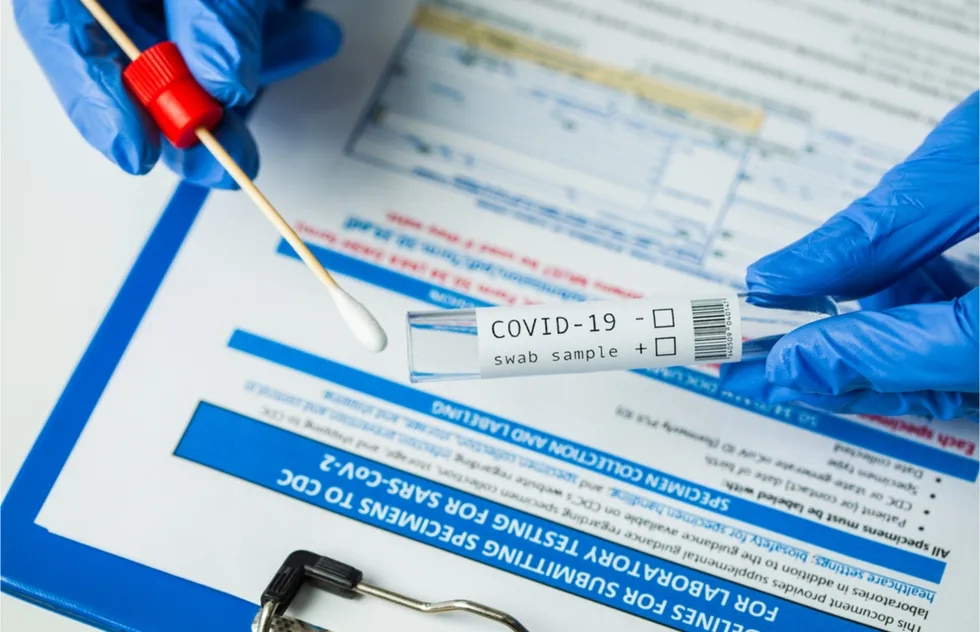 Covid 19 test, antigen test, coronavirus