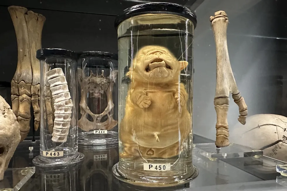 Hunterian Museum, London