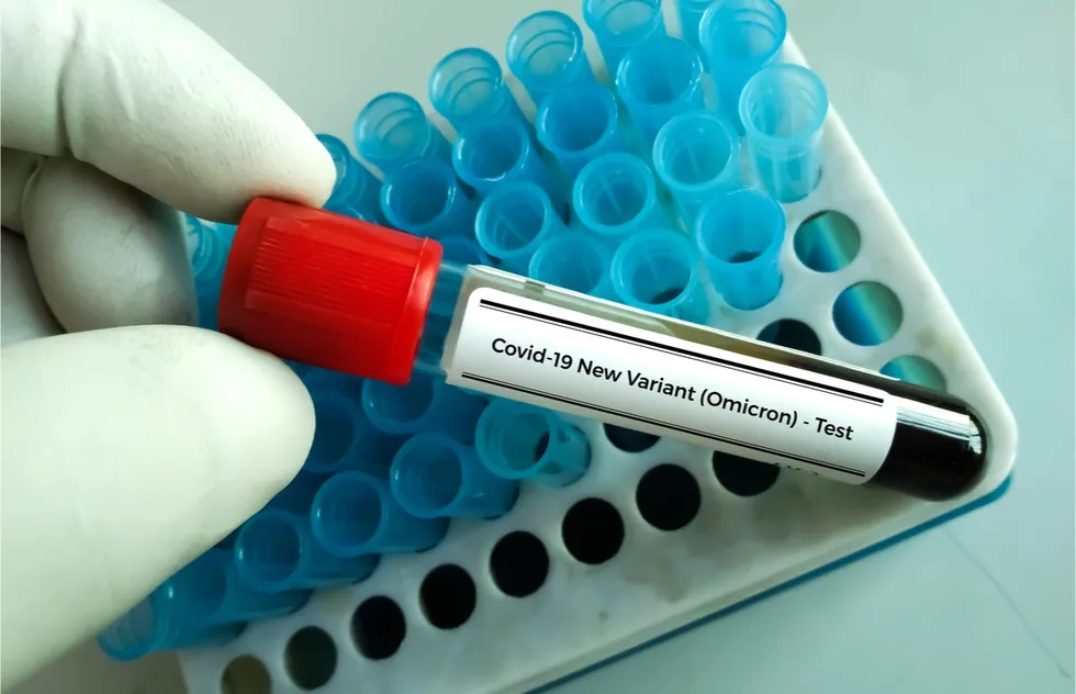 Omicron test