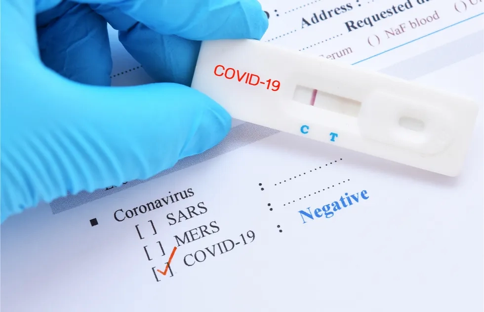 Covid-19 negative test result in lab