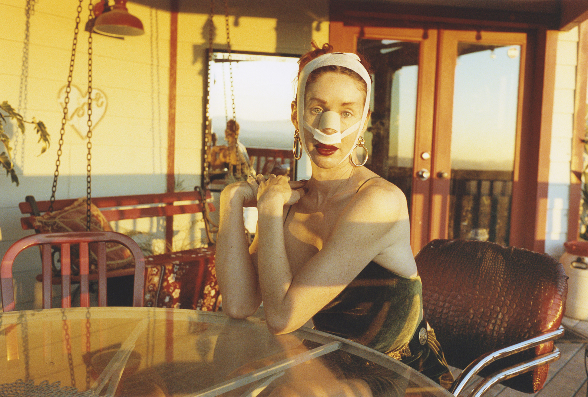 Woman wearing headband and bandage covering her mouth, seated on a swing chair on a balcony overlooking the ocean.