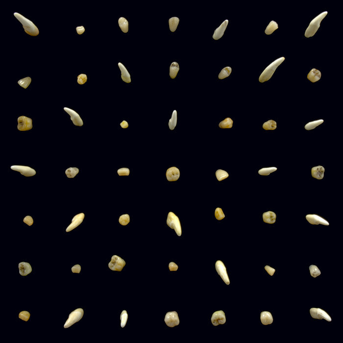 A0034985728 16