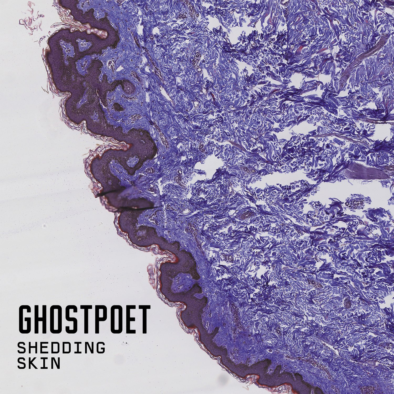 Shedding skin