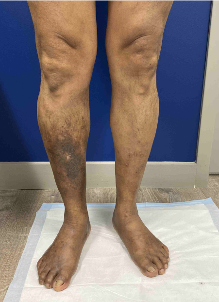 JD AFTER PHOTO102125