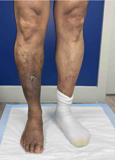 JD BEFORE PHOTO 070125