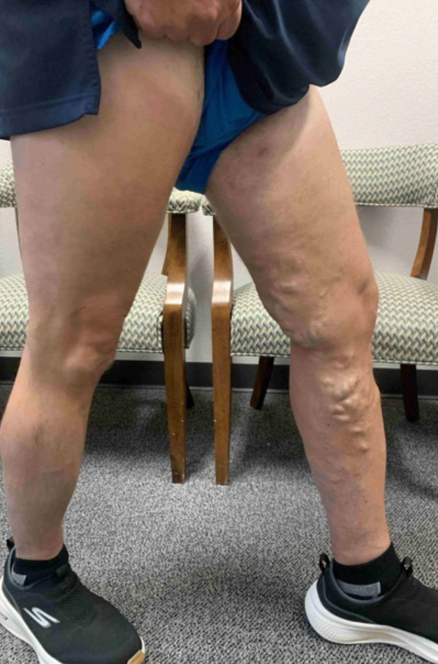 Jeffrey Hubbard after