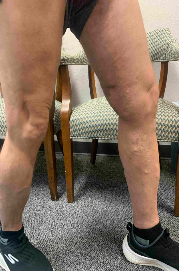 Jeffrey Hubbard before