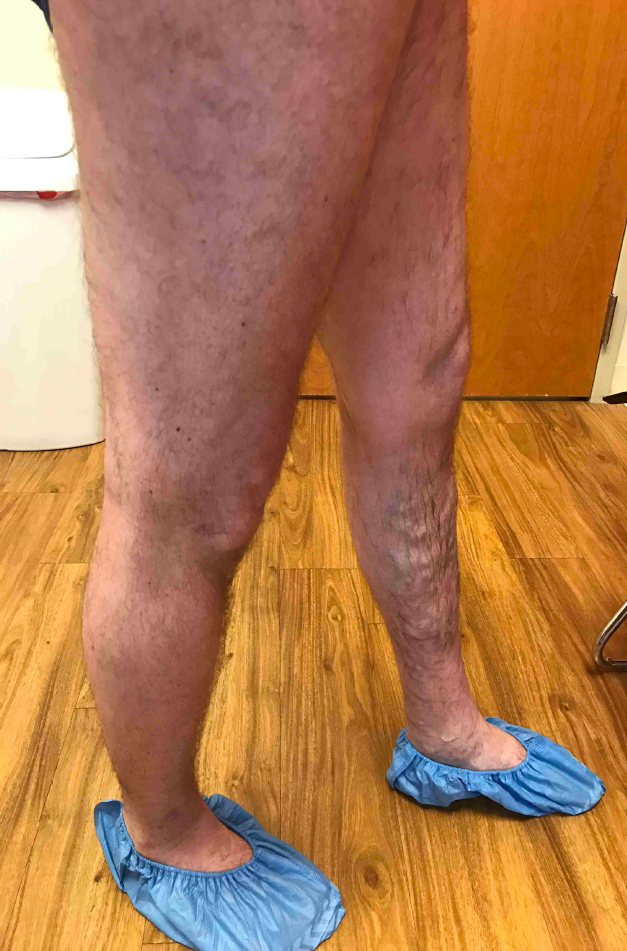 Justin Bitner Before