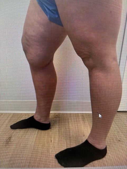 Kayla Bean after