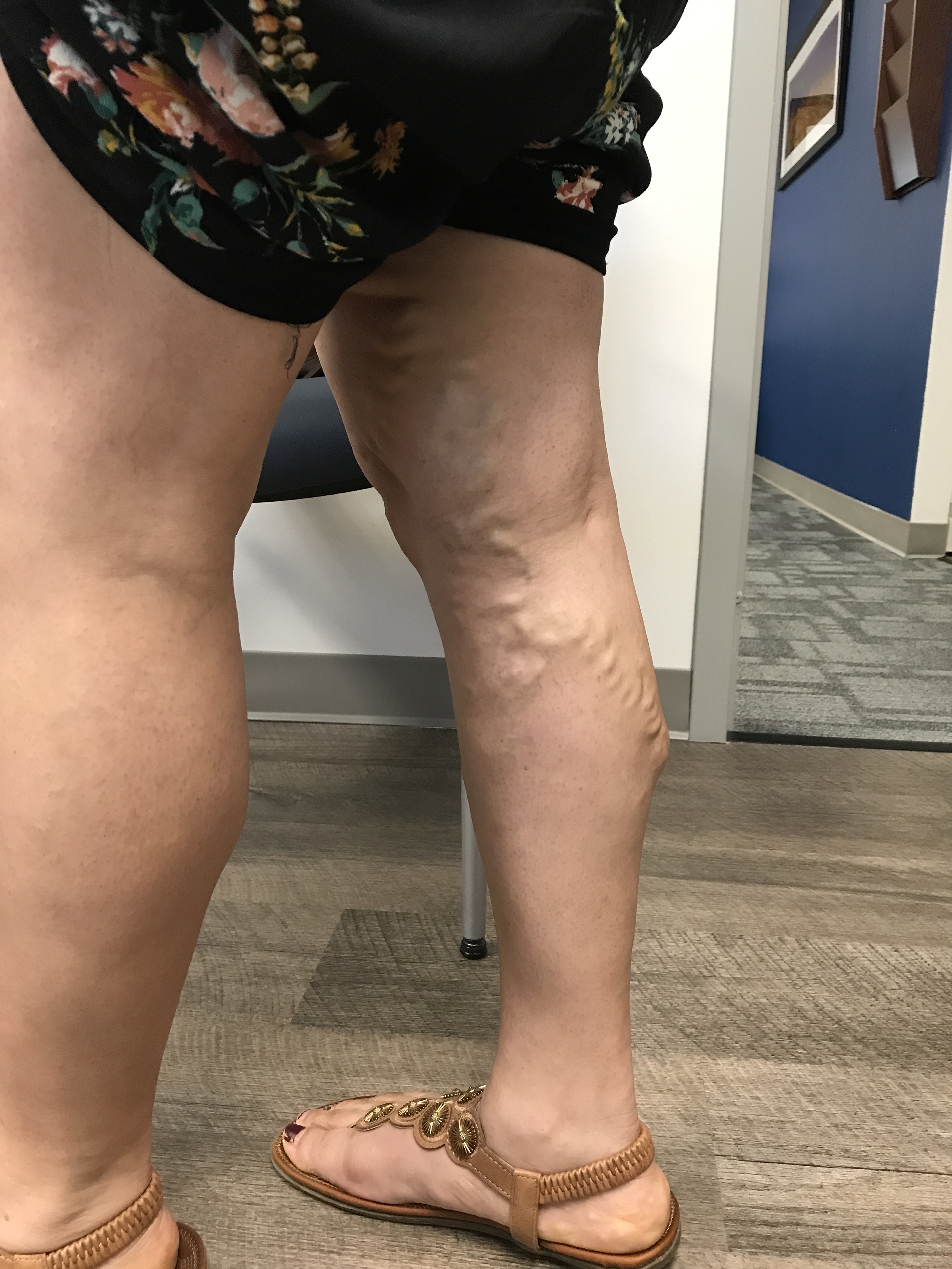 Mrn 259206 pre op image