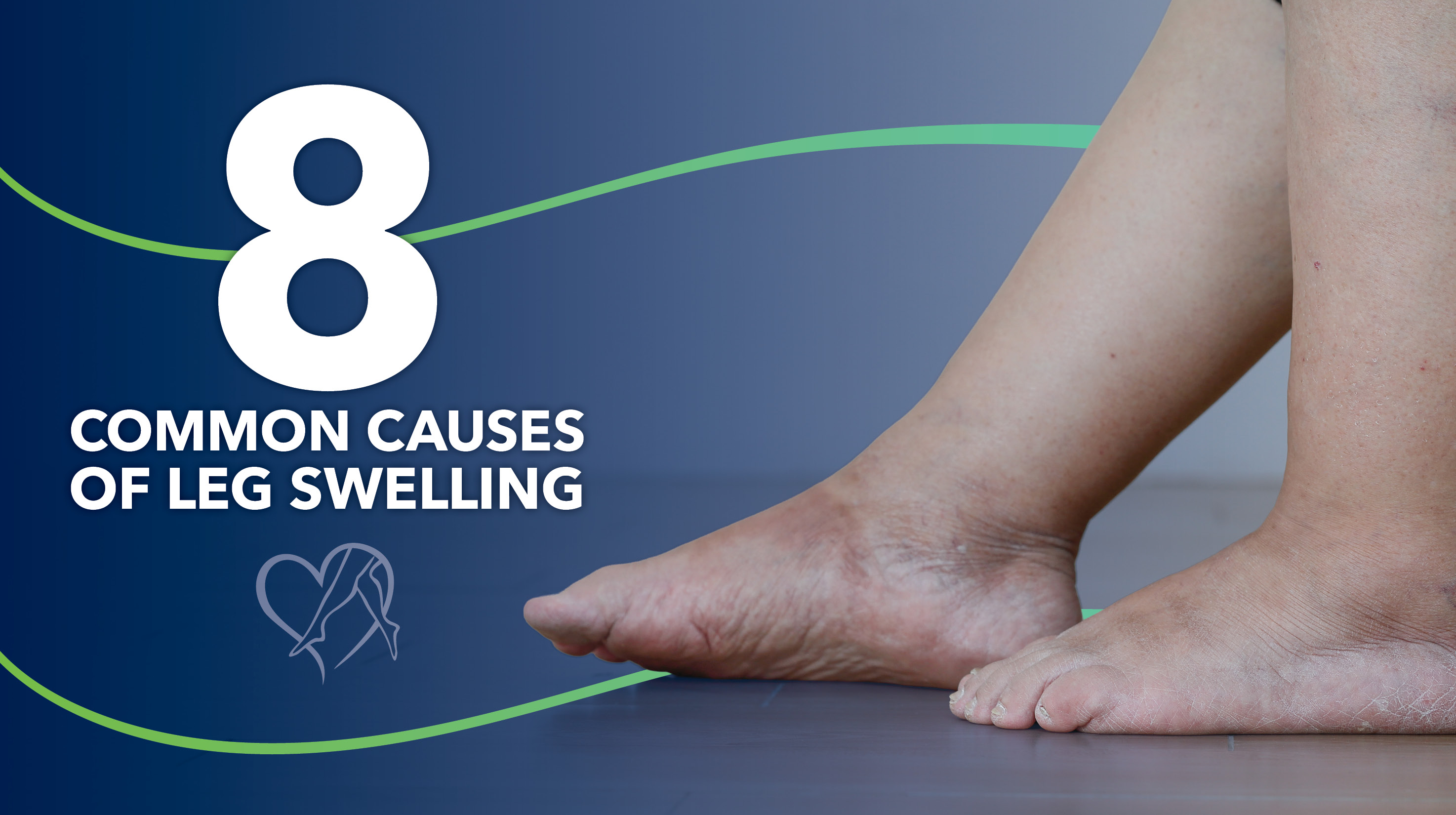 Blog 8 Causes of Leg Swelling