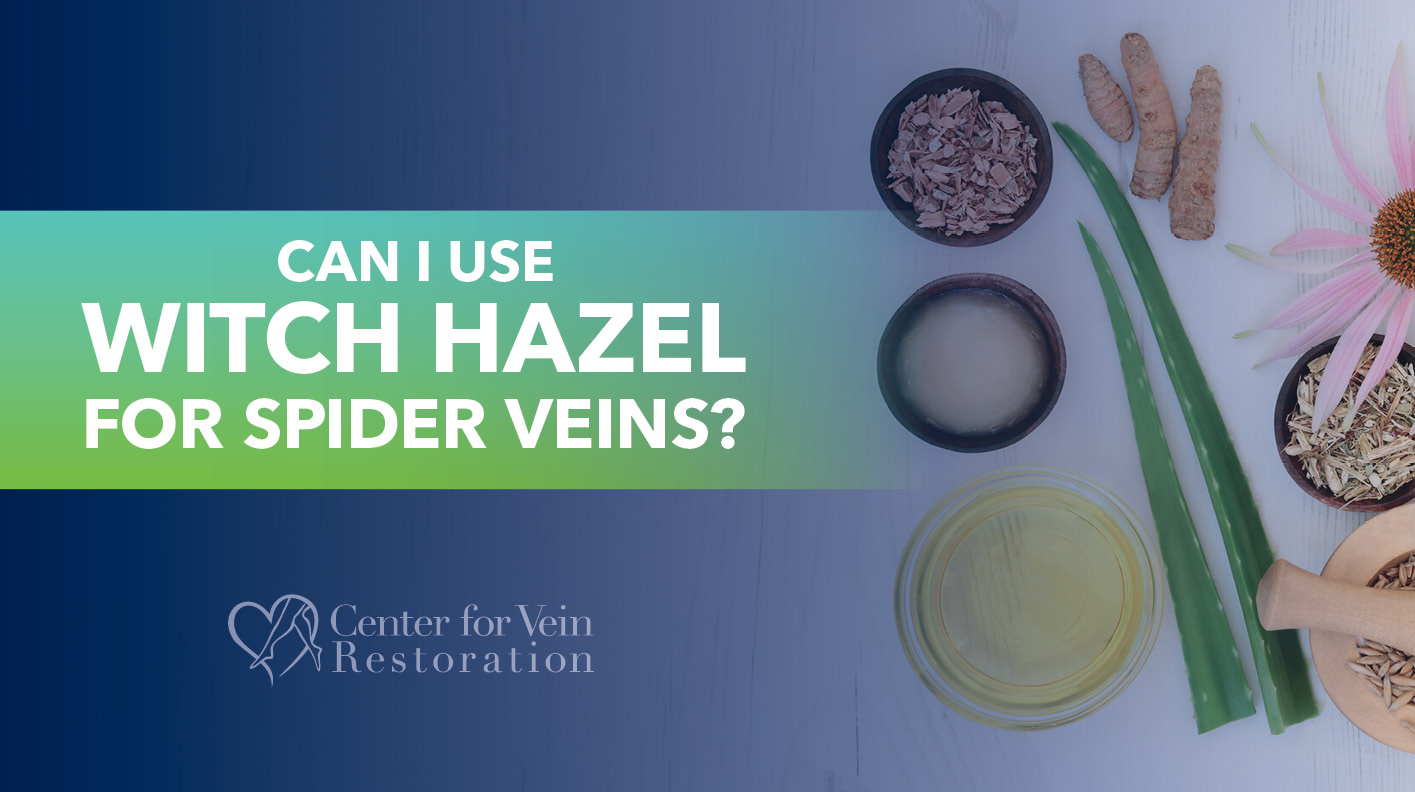 Blog Can I Use Witch Hazel for Spider Veins