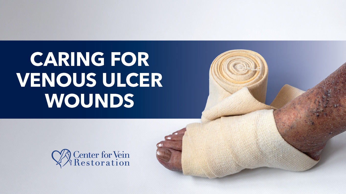 Blog Caring for Venous Ulcer Wounds