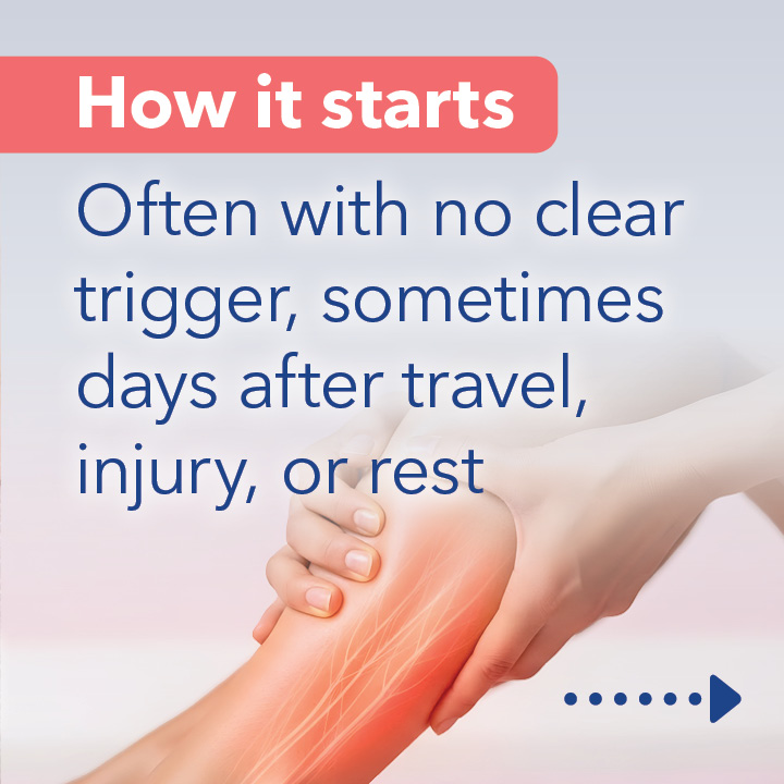 Blog Carousel Blood Clots In Athletes DVT2