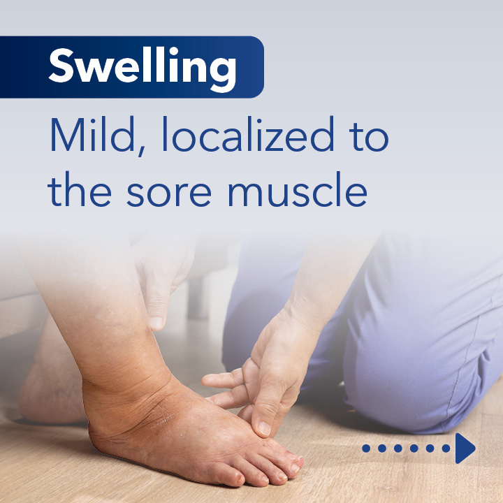 Blog Carousel Blood Clots In Athletes Muscle Strain3