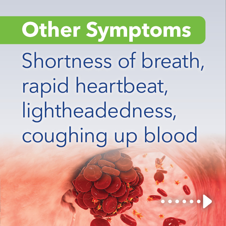 Blog Carousel Blood Clots In Athletes PE6