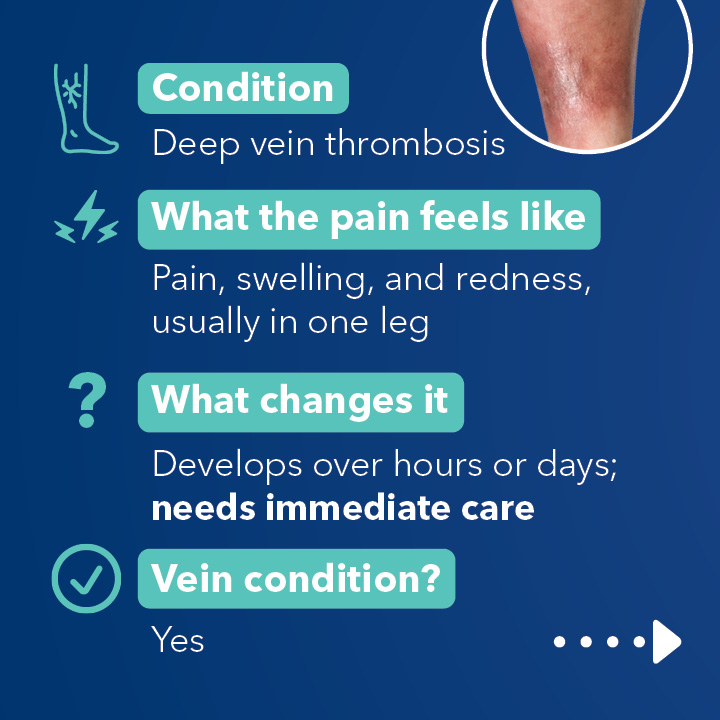 Blog Carousel Leg Pain Comparison 5 Causes Of Leg Pain3