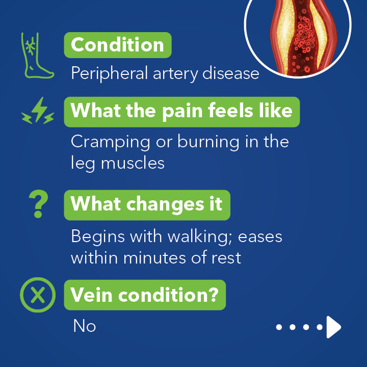 Blog Carousel Leg Pain Comparison 5 Causes Of Leg Pain4