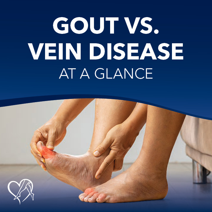 Blog Slider Gout vs Vein Disease