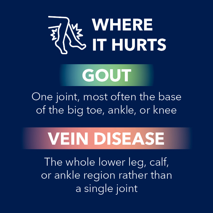 Blog Slider Gout vs Vein Disease2