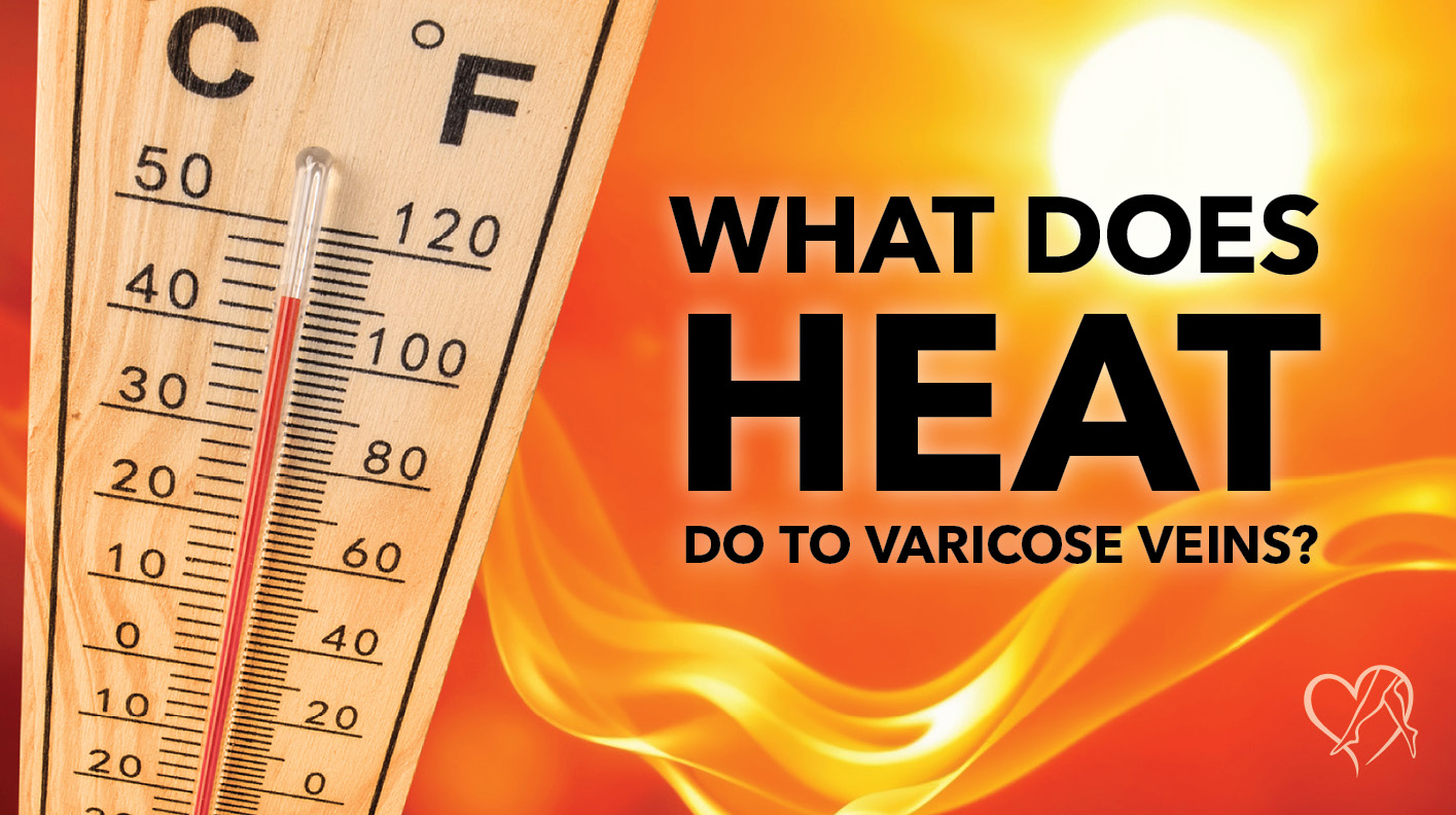 Blog What Does Heat Do to Varicose Veins