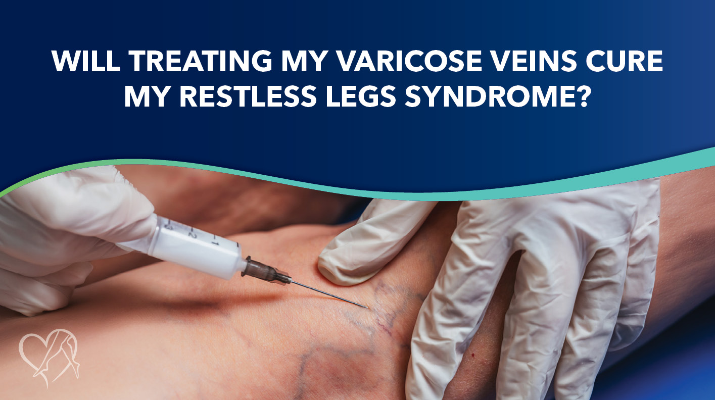 Blog Will Treating My Varicose Veins Cure My RLS