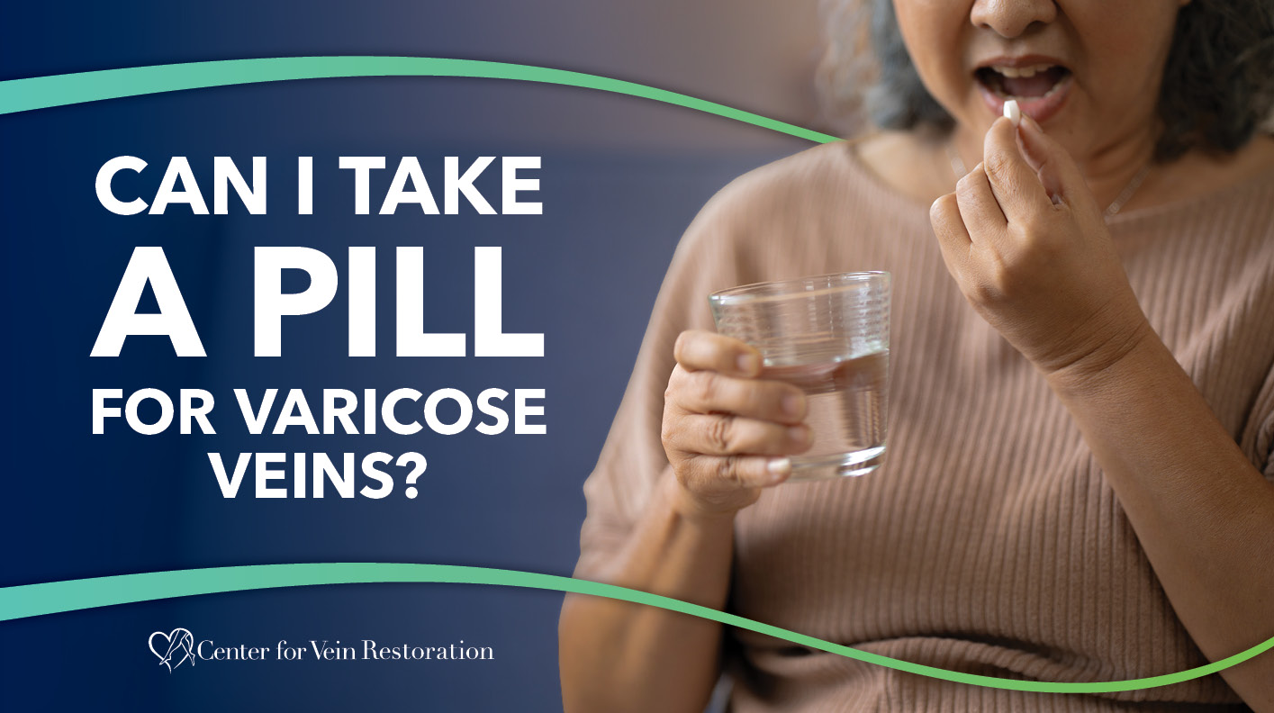Blog Image Can I Take a Pill for Varicose Veins