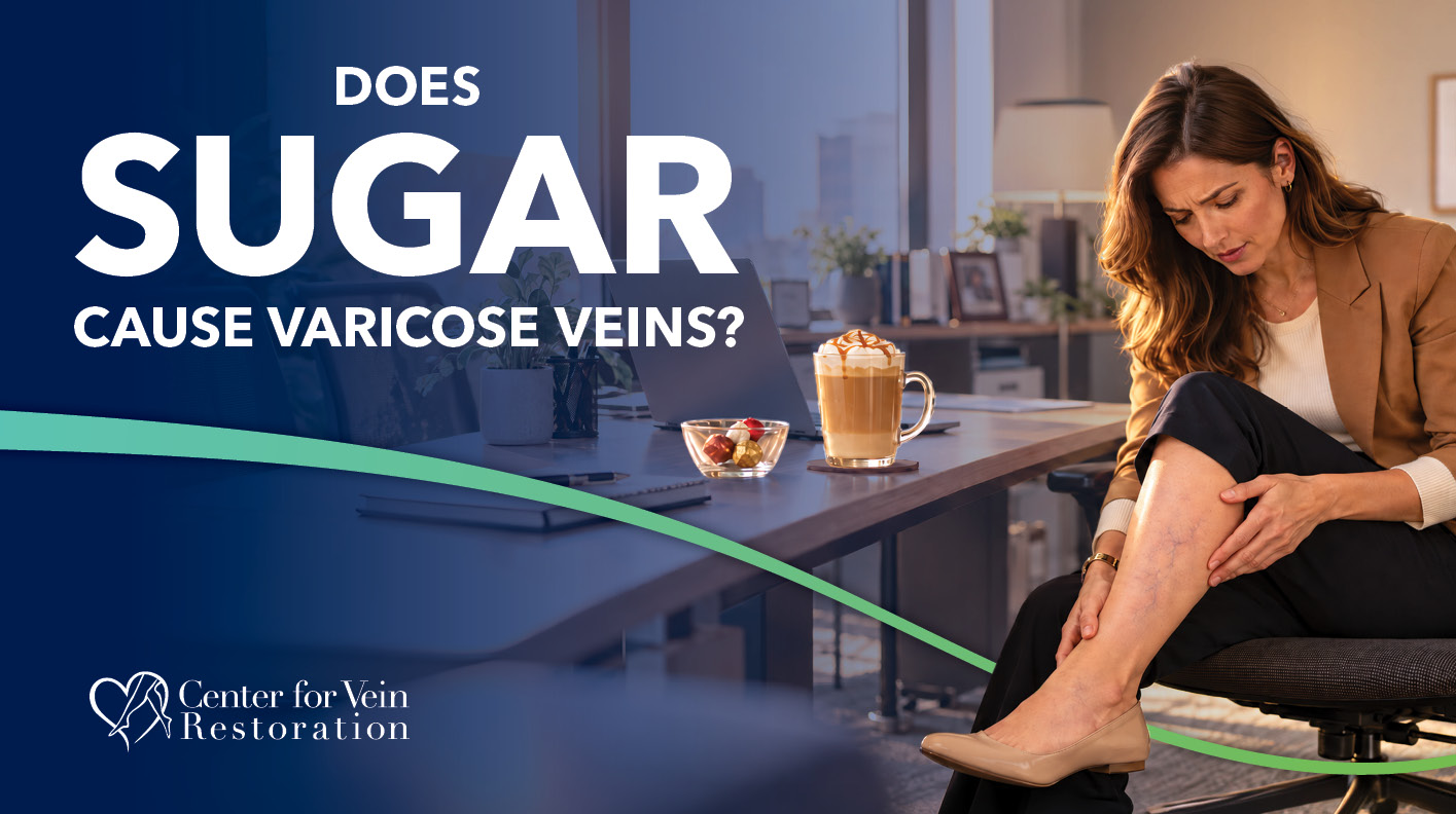 Blog Image Does Sugar Cause Varicose Veins