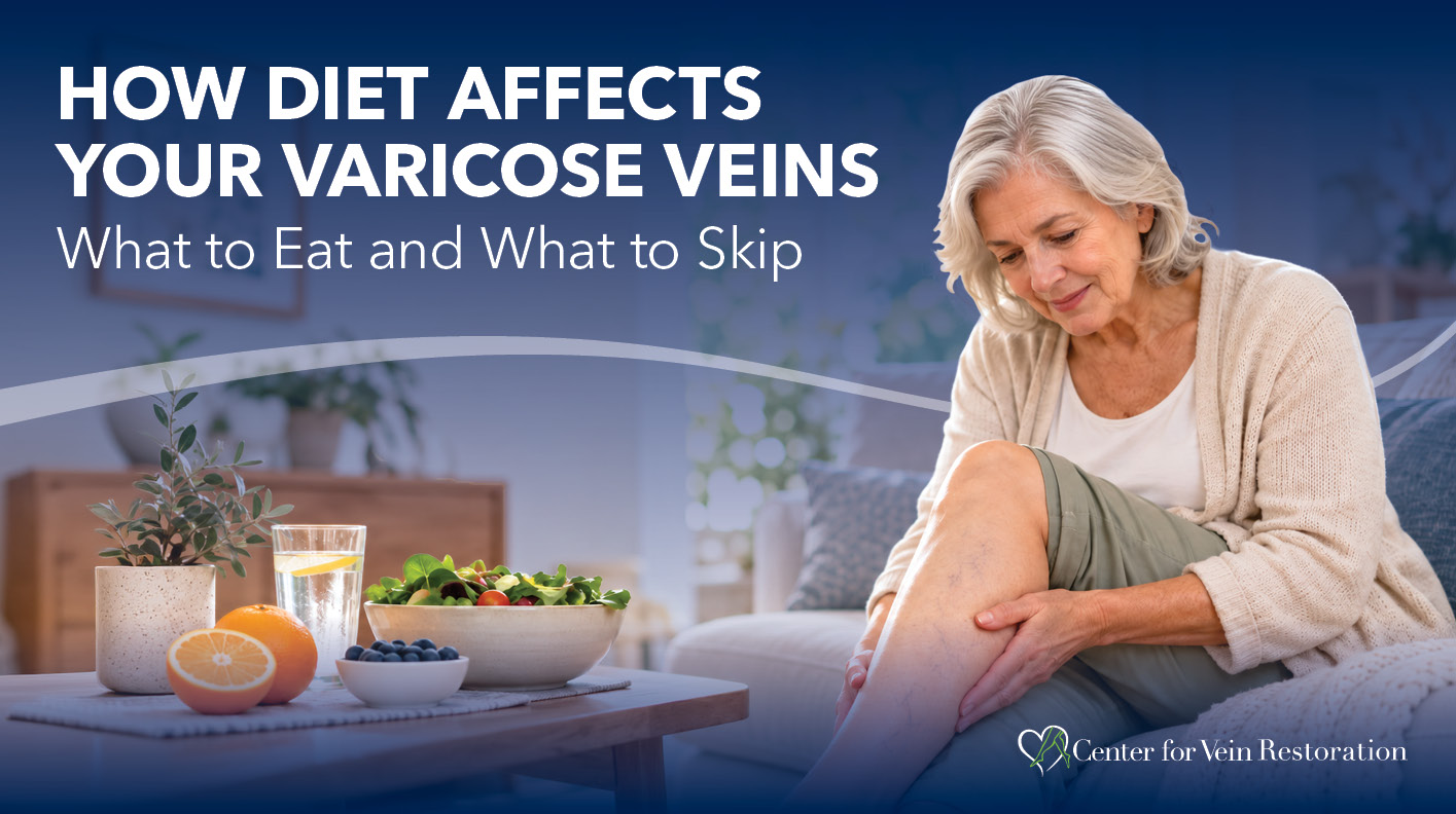 Blog Image How Diet Affects Your Varicose Veins
