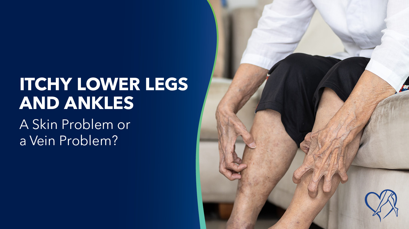 Blog Image Itchy Lower Legs