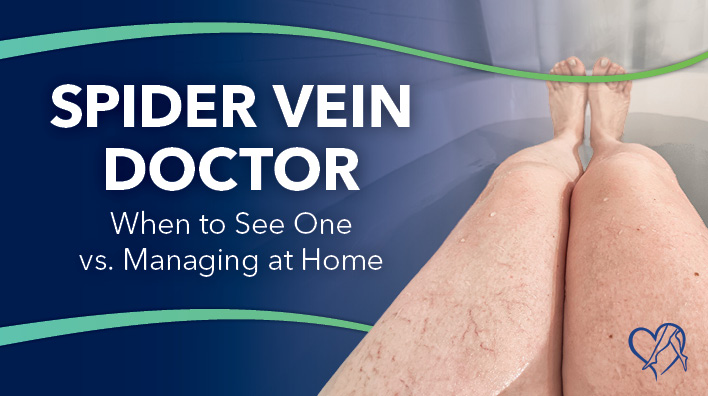 Blog Image Spider Vein Doctor