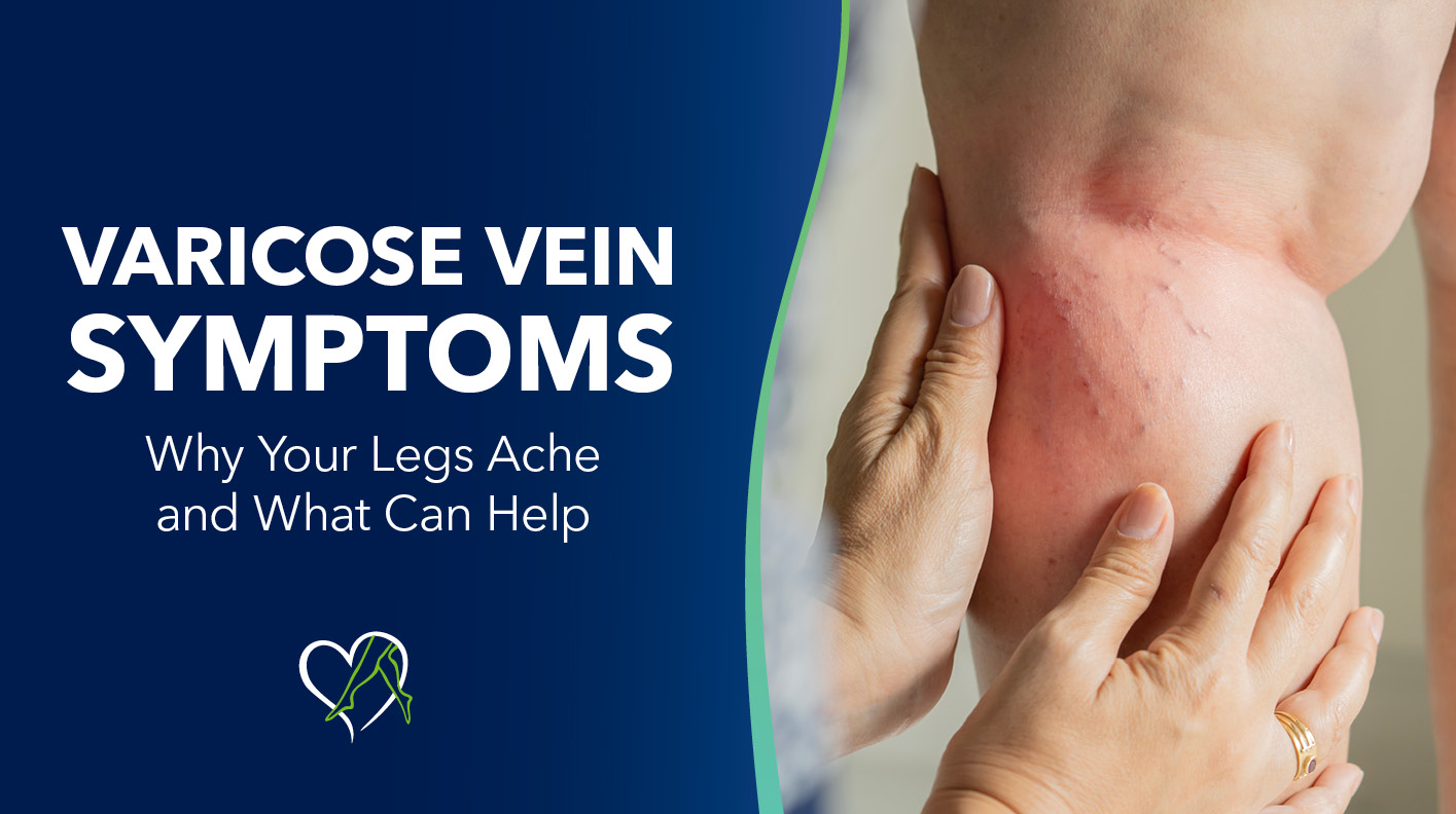 Blog Image Varicose Vein Symptoms