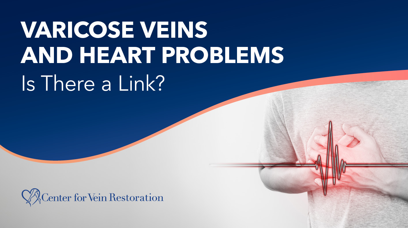 Blog Image Varicose Veins and Heart Problems Is There a Link