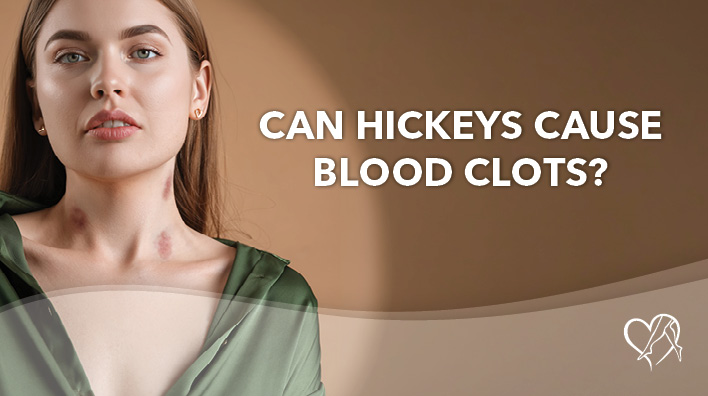 Blog Image Can Hickeys Cause Bloot Clots